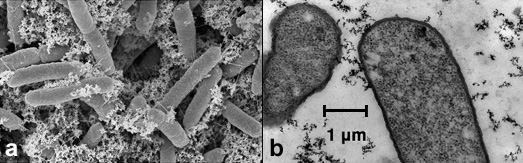 SEM and TEM microscope images of magnetic nanofactories attached to E. coli cells
